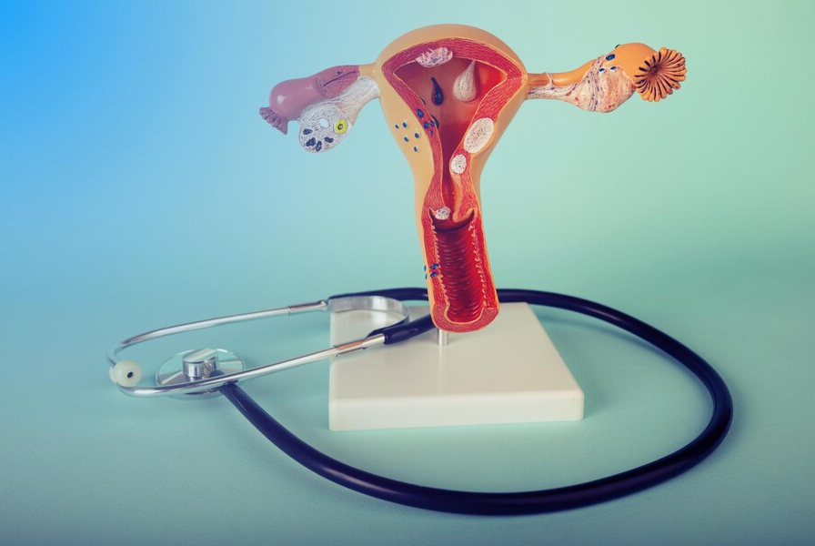 Harsha Hospital-Hysteroscopy